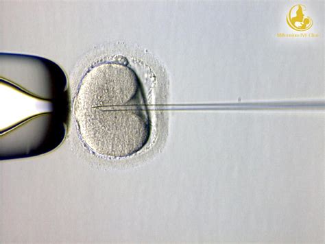 Mikroskopinis ICSI procedūros vaizdavimas