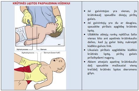 Kūdikių krūtinės ląstos rentgenograma, rodanti plaučių uždegimą