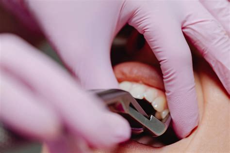 Infografika: Rekomendacijos po danties rovimo