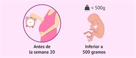 Medicininio aborto schematinis vaizdavimas