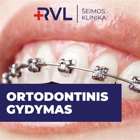 ortodontinis gydymas breketais