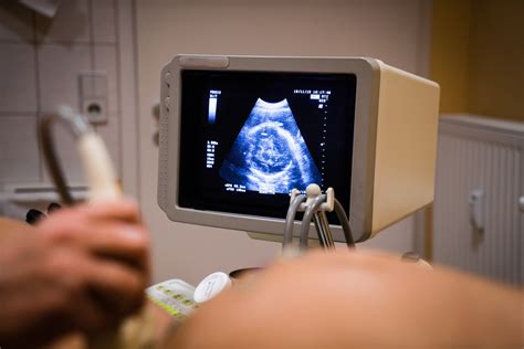 Ultragarso nuotrauka, iliustruojanti gemalo kampo teoriją
