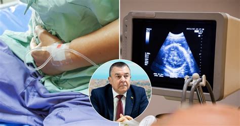 Statistika apie abortus Lietuvoje