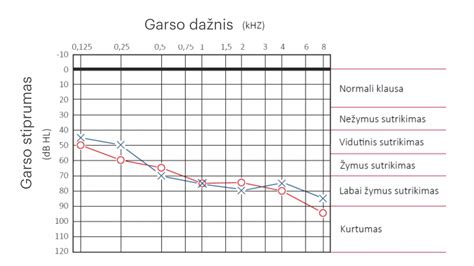 Klausos sutrikimo laipsnių lentelė