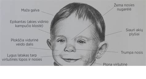 Vaiko veidas su išmuštu dantimi
