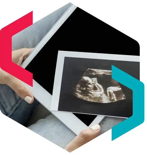 Neinvaziniai prenataliniai tyrimai schema