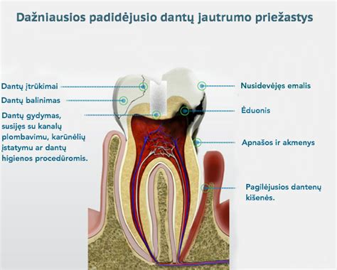 priežastys dėl kurių geltonuoja dantys