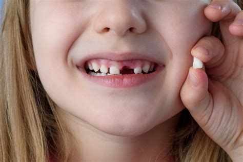 vaiko dantų traumos prevencija