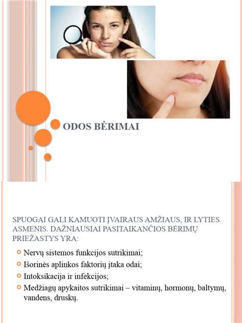 Infografika: Dažniausi kūdikių odos bėrimai