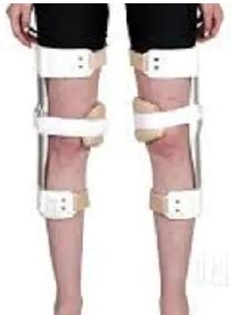 vaiko kaulų deformacijos