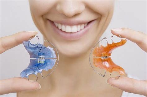 Ortodontinės plokštelės vaikams