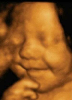 4D echoskopijos vaizdas, kuriame matomas judantis vaisius