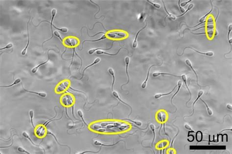Spermatozoidų kelionė moters reprodukciniame takelyje