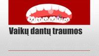 vaikų dantų traumos tipai