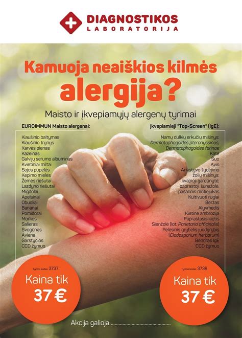 Infografika, lyginanti tradicinius ir komponentinius alergijos tyrimus