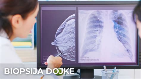 Schematinis krūtų įkloto sluoksnių pavaizdavimas