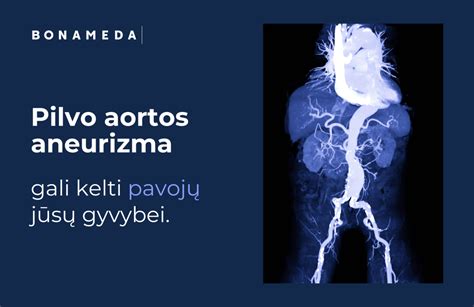 Schema, kaip susidaro pilvo aortos aneurizma