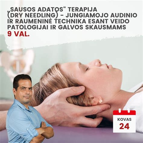 Akupunktūros schematinis vaizdas