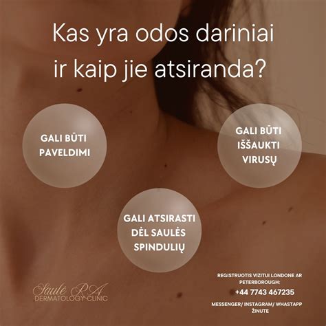 Schema, kaip atsiranda strijos dėl odos tempimo