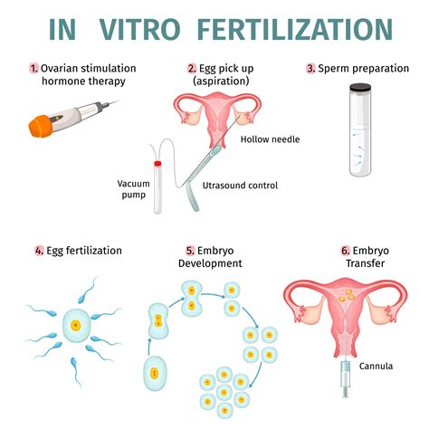 vizualizacija apvaisinimo in vitro proceso