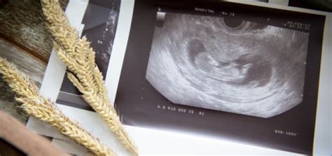 ultragarsinio tyrimo metu matuojamas vaisiaus sprando raukšlės storis