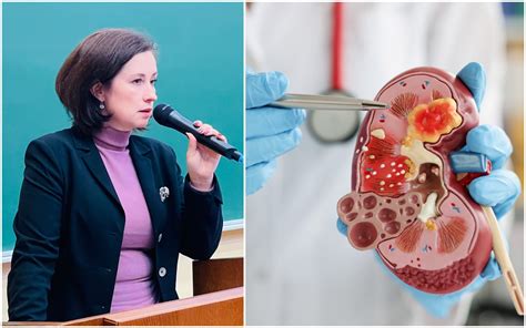 Statistika apie šlapimo nelaikymo paplitimą Lietuvoje