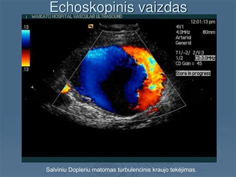 vaisiaus anatomijos echoskopinis vaizdas