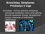 simptomai ir priežastys vaikų bronchitas