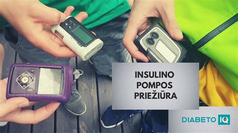 Schema, kaip pasirinkti tinkamą vietą insulino pompos kateteriui