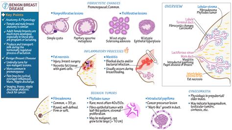 Infografika: Mastito simptomų palyginimas (laktostazė vs. mastitas)
