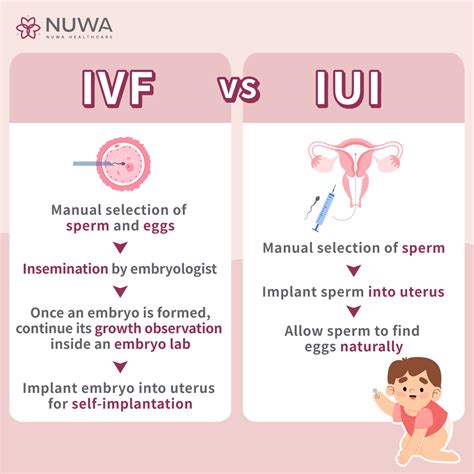 Infografika: palyginimas IUI ir IVF