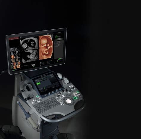 3D ir 4D ultragarsinis nėštumo tyrimas