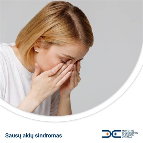 sausų akių sindromo schema