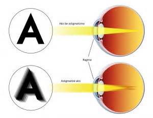 vaiko akys su trumparegyste