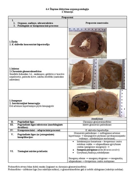 Inkstų komplikacijų schema