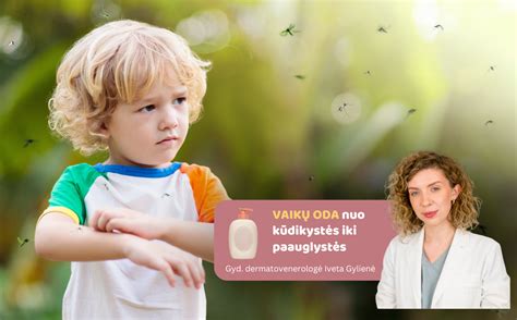 neužgijusios bambos priežiūra