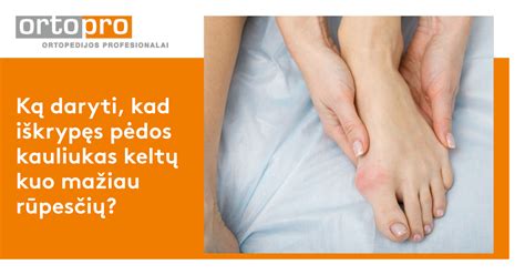 Palyginimas: sveika pėda ir pėda su Hallux Valgus (iššokusiu kauliuku)