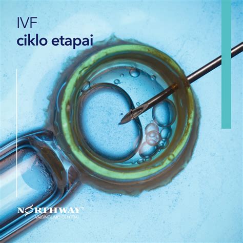 IVF procedūros schema: kiaušialąsčių paėmimas, apvaisinimas, embrionų auginimas ir perkėlimas