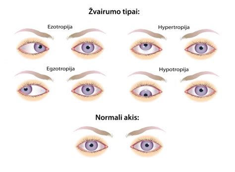 Schema: žvairumo tipai ir akių judesiai