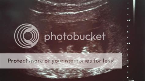 vaisiaus vystymasis 39 savaitę