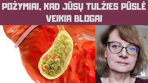 Anatomija, rodanti apendikso vietą pilve