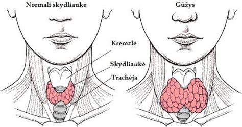 schematinė skydliaukės anatomija