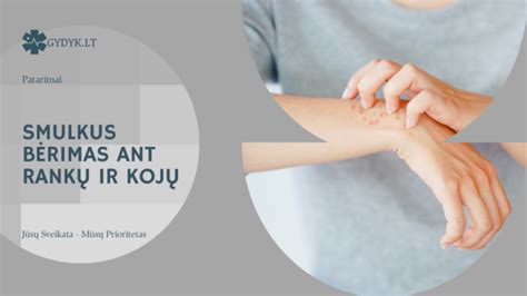 Nuotrauka: bėrimai ant rankų ir kojų