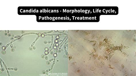 Mikroskopinis Candida albicans grybelio vaizdas