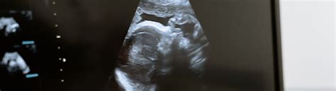 Nėštumo testas ir vaisiaus echoskopijos nuotrauka