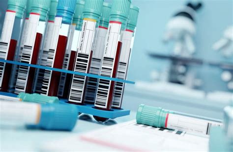 schemą, kaip atliekami kraujo tyrimai nevaisingumo diagnostikai