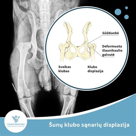 Scheminė klubo sąnario displazijos iliustracija