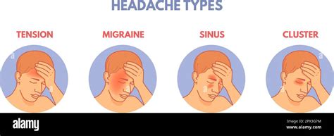 schema of human head with areas of pain