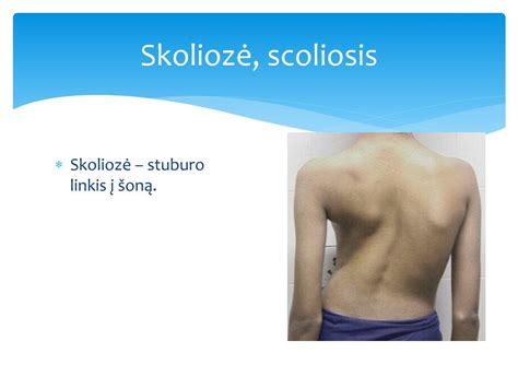 stuburo linkiai ir kūdikio raida