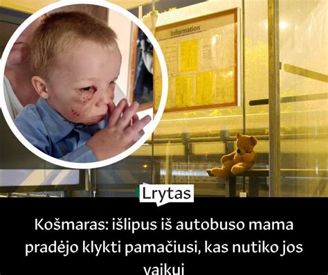 vaikas sužeistas